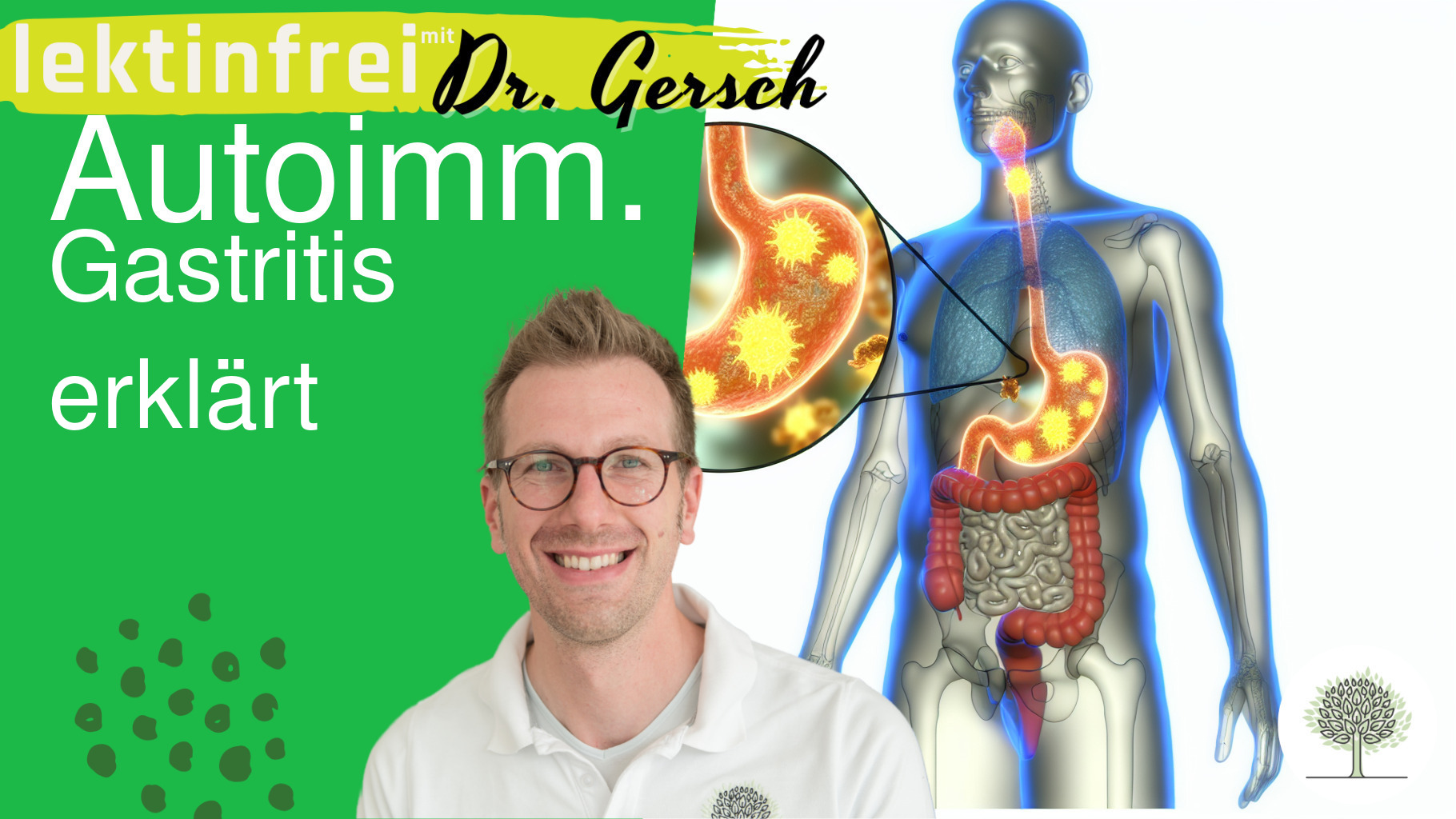 Einführung in die Autoimmungastritis, Pathophysiologie und Ursachen 