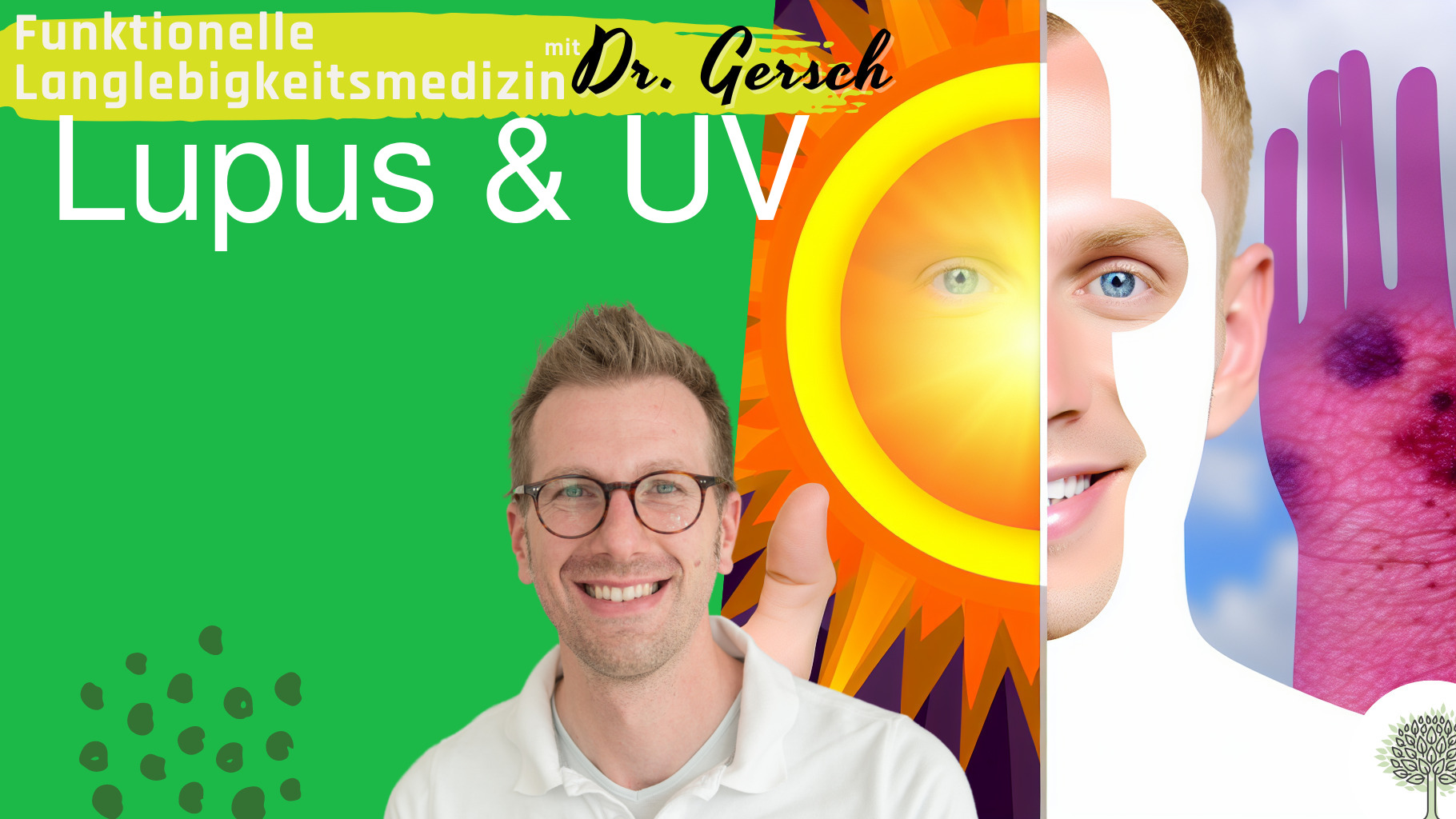 Carotinoide bei Lupus: Warum verschlechtert sich Lupus durch Sonneneinstrahlung? 