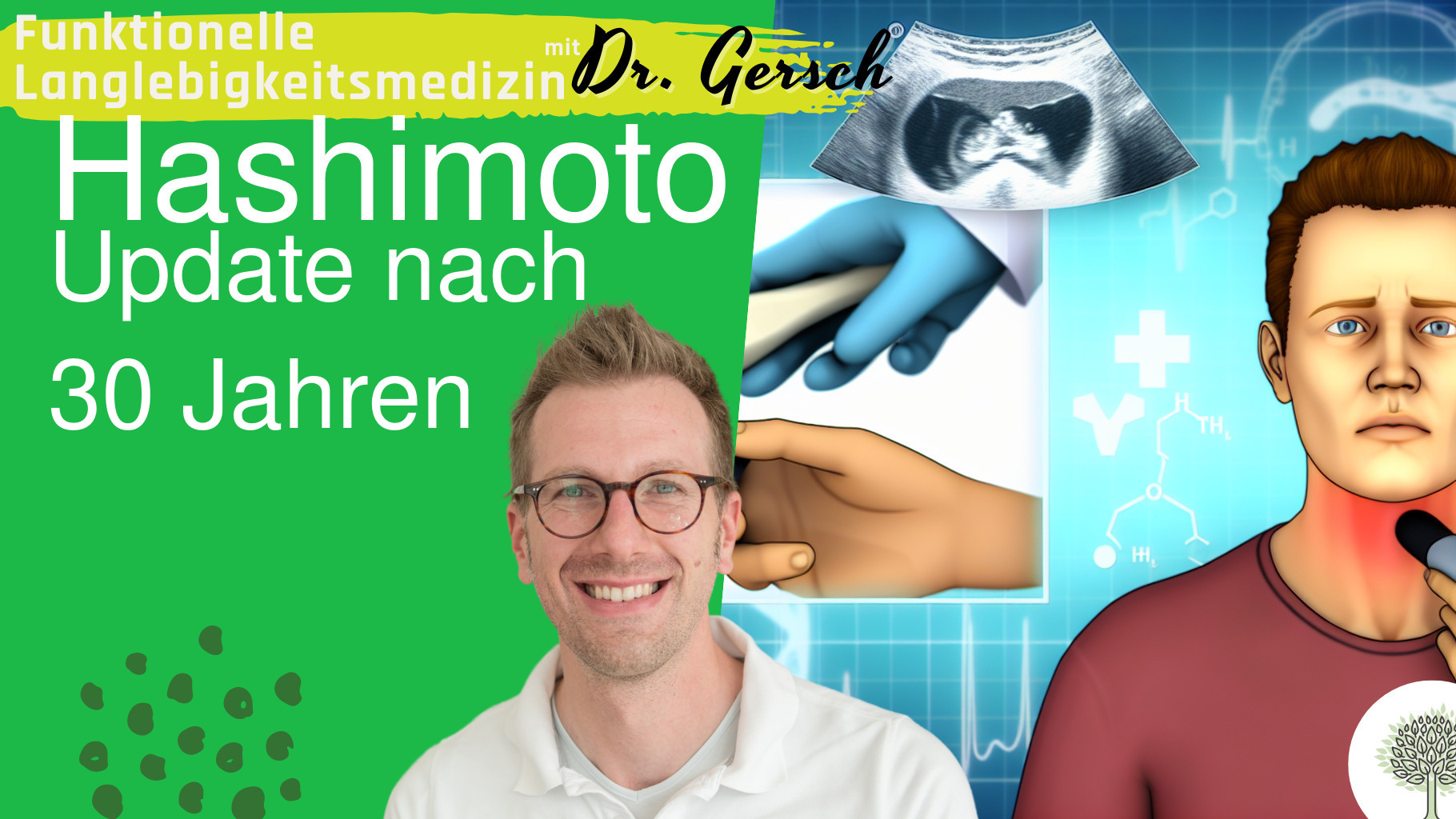  Kann ich auch nach 30 Jahren Hashimoto noch L-Thyroxin absetzen? 