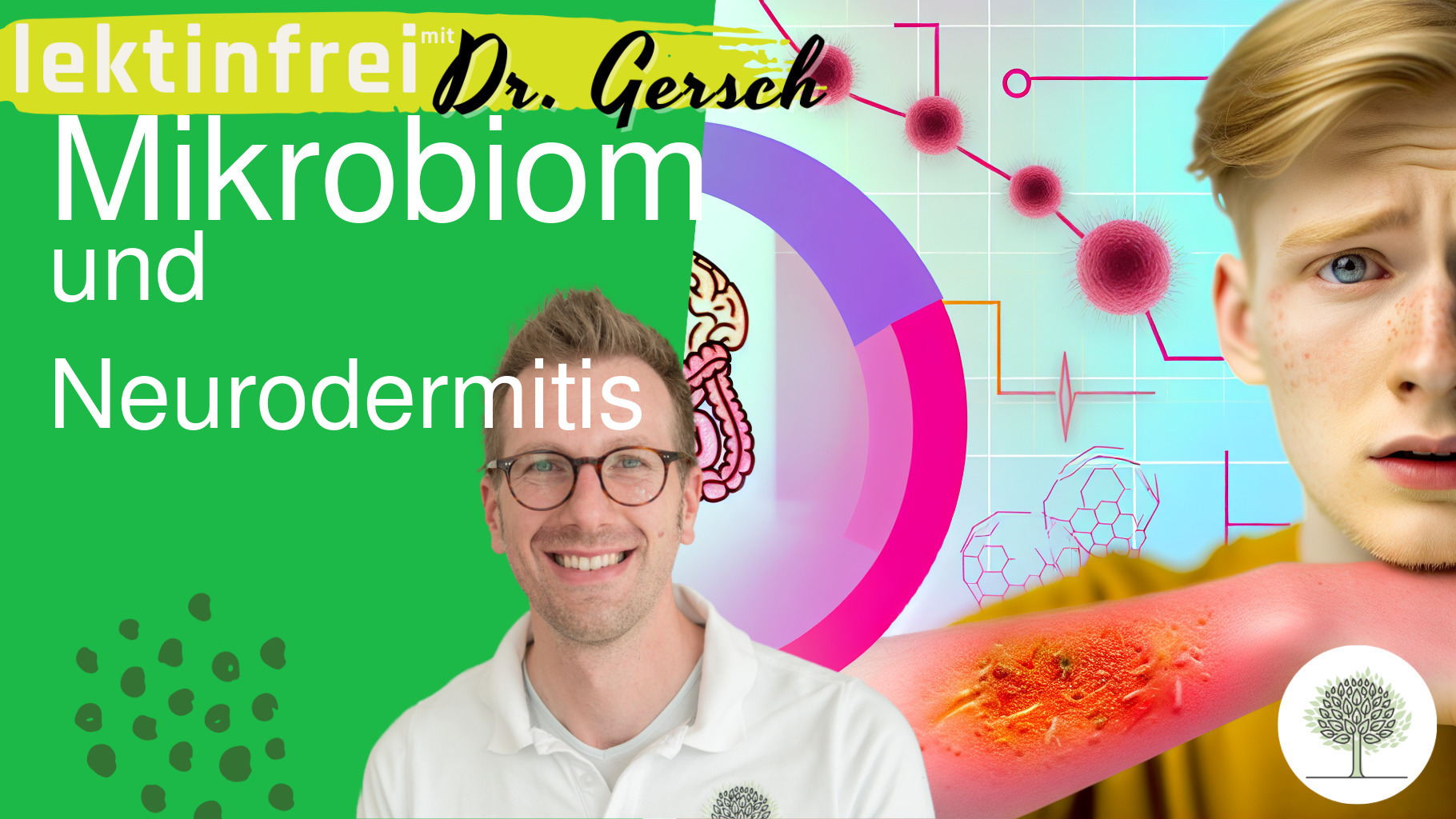 Wie hängt Neurodermitis mit einem gestörten Mikrobiom zusammen, und was kann man tun? 