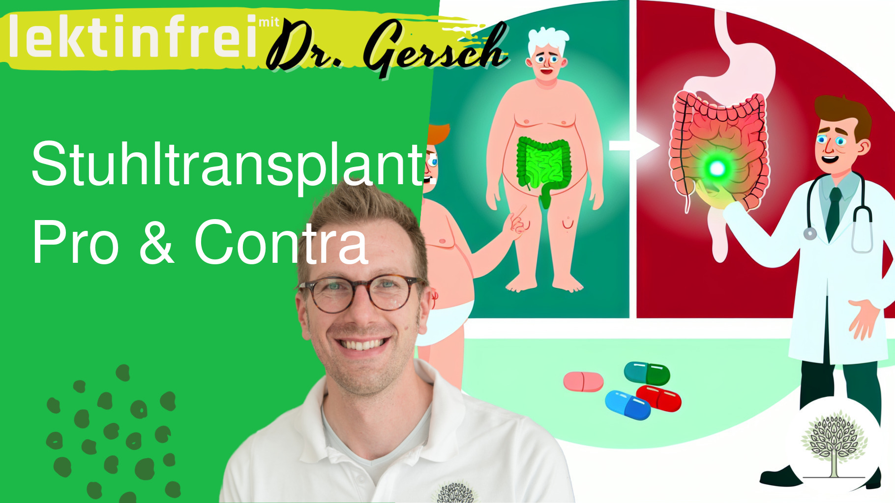  Dr. Gerschs Meinung zu Stuhltransplantationen - Was spricht dagegen? Was spricht dafür?